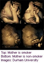 Fetal Faces Seem to React to Mom’s Smoking