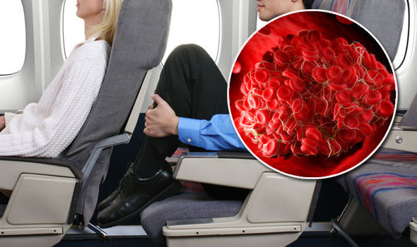 When Bad Blood Clots Ruin Good Flights: How To Prevent DVT.